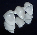 Bridge framework in zirconia