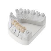 Ceramic four unit bridge