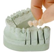 incise 3 unit bridge