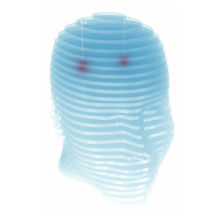 Perspex head demonstrating CED