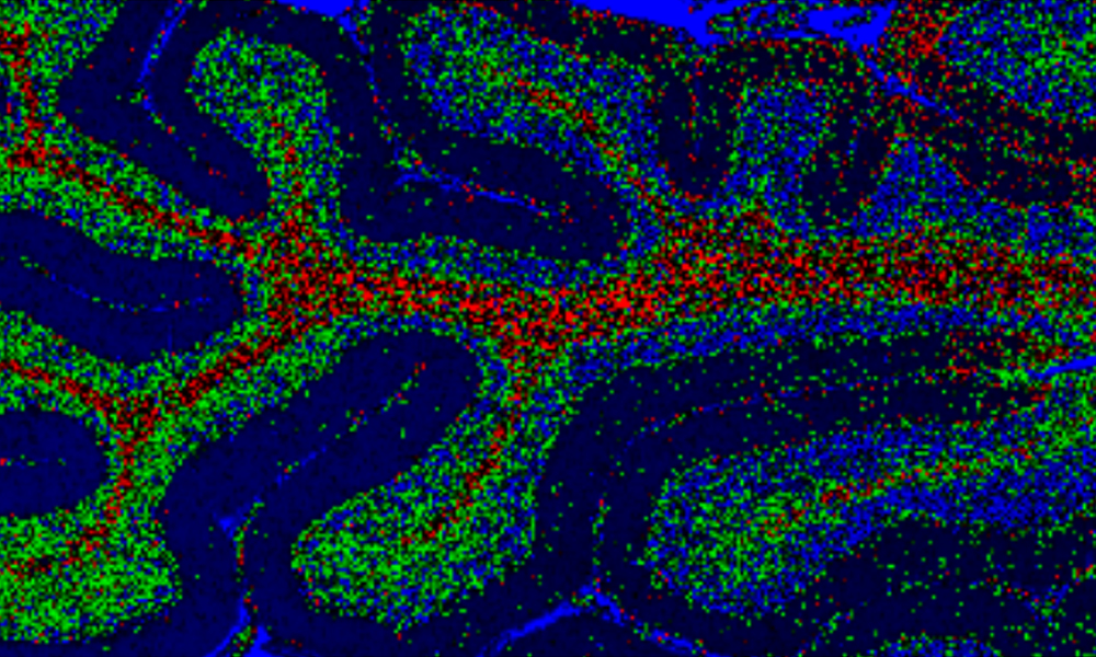 Raman image of brain tissue
