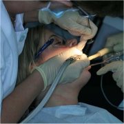 Dentist preparing tooth