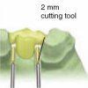 Checking pontic gaps