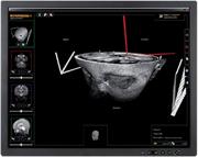 neuroinspire™ screenshot 2