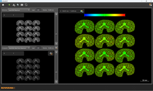 2D image of tibial tray taken from InfiniAM spectral software
