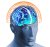 Neurological halo image