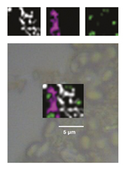 Microbe identification