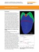 StreamLine imaging of a complete tooth