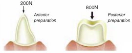 Anterior and posterior copings