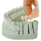 incise 3 unit bridge