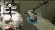 neuromate® robot with drill attachment and frame, used for reference and to rigidly support the skull