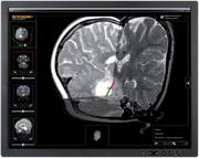 neuroinspire screenshot 3