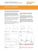 Renishaw's SynchroScan