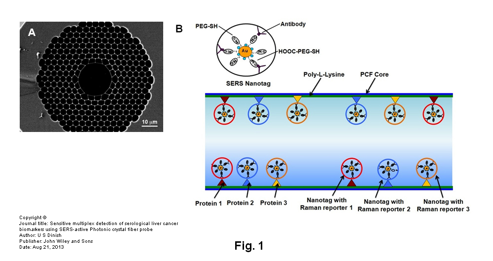 Case study:  Case study:  © Singapore Bioimaging Consortium (SBIC)