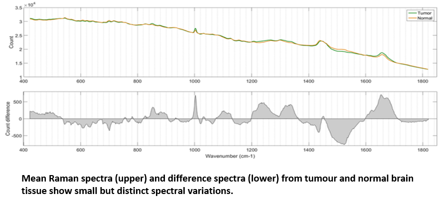 Raman spectra of tumour and healthy brain tissue