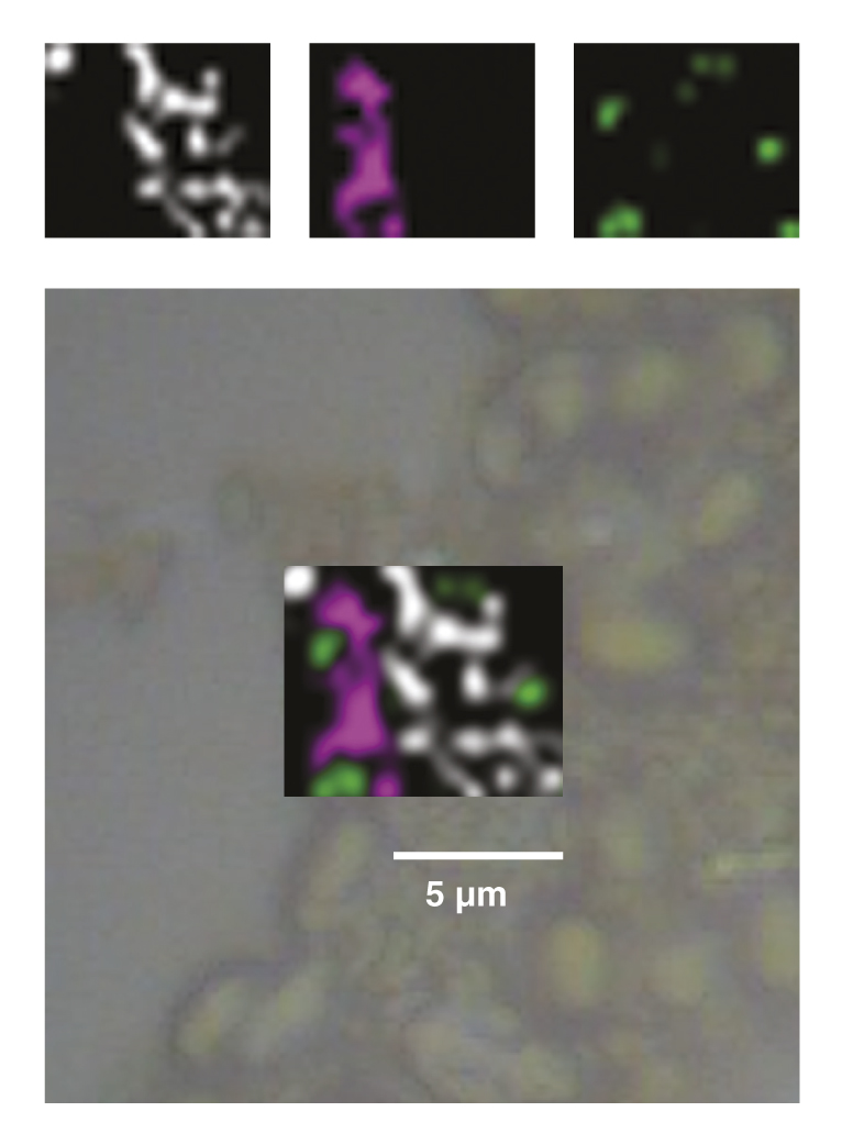 Microbe identification