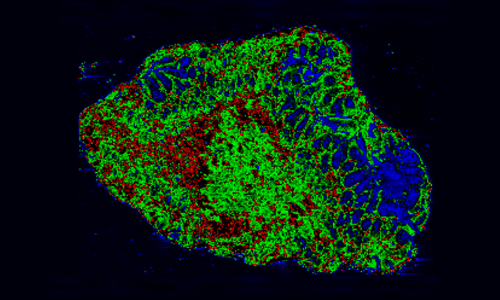 Raman image of biochemical material