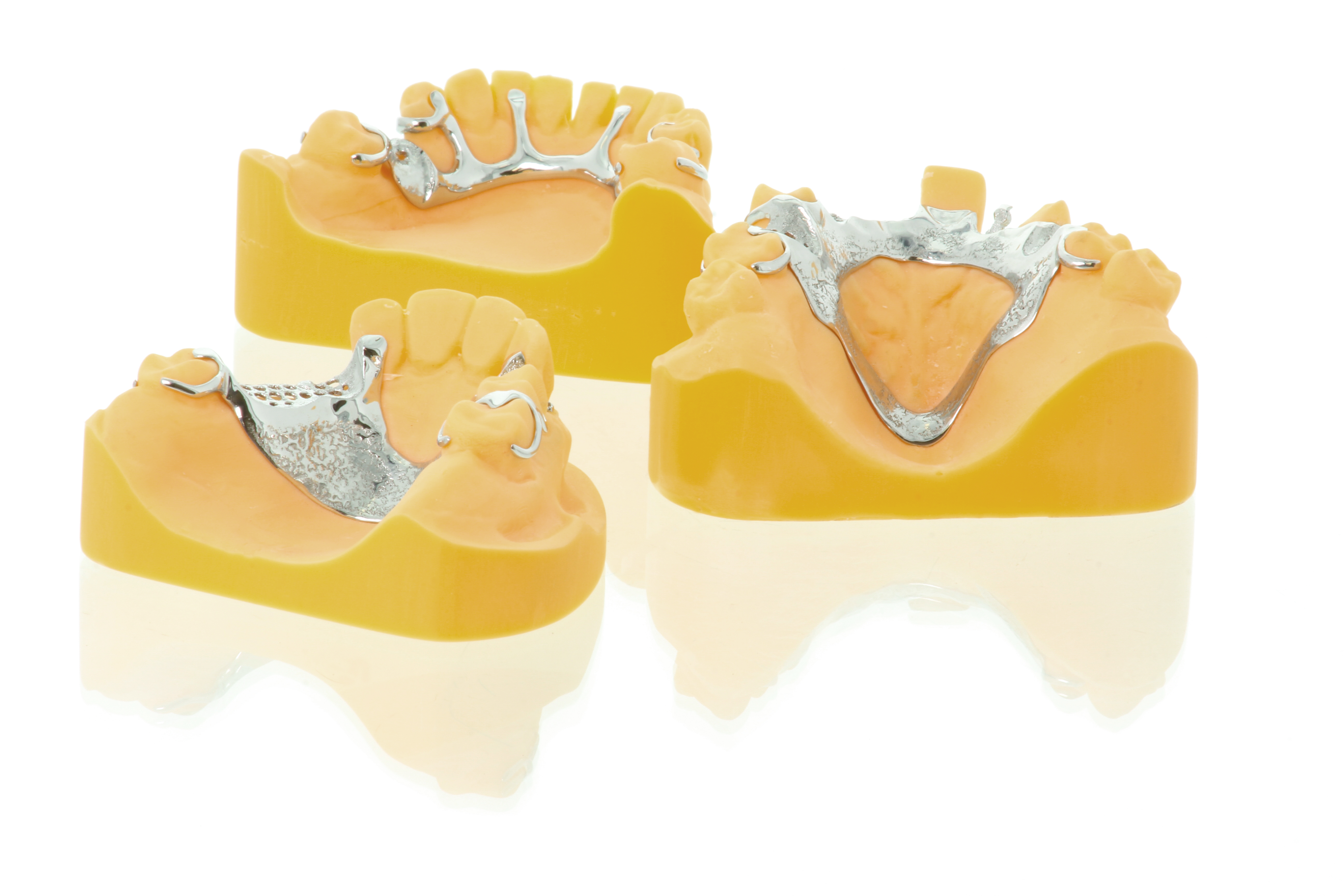 how to make a removable partial denture