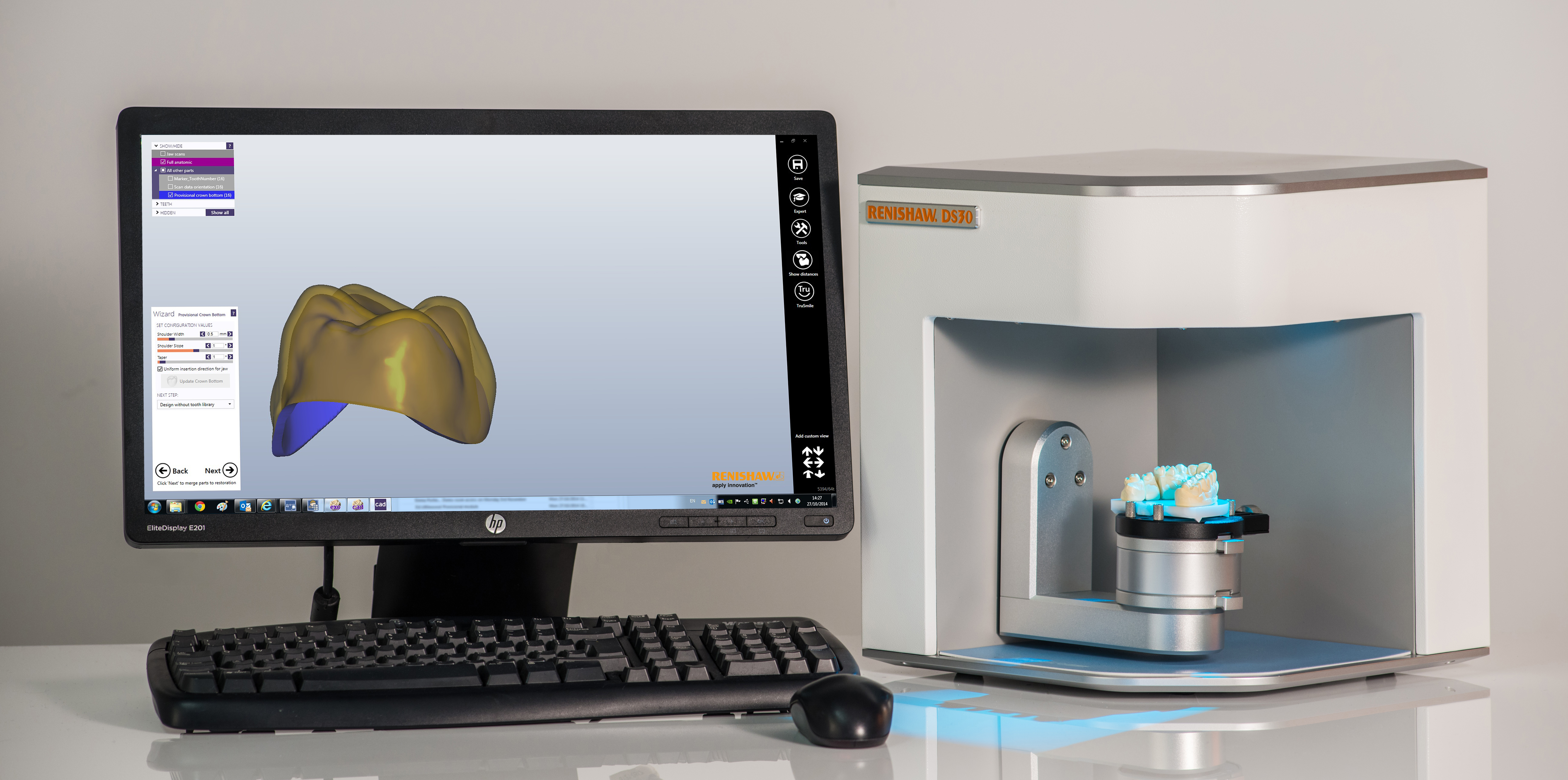 DS30 scanner coupled with Renishaw Dental Studio (RDS) for design