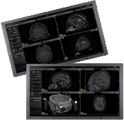 neuroinspire - monitor tumble