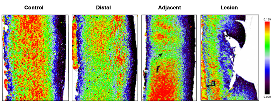 Cartilage Raman image