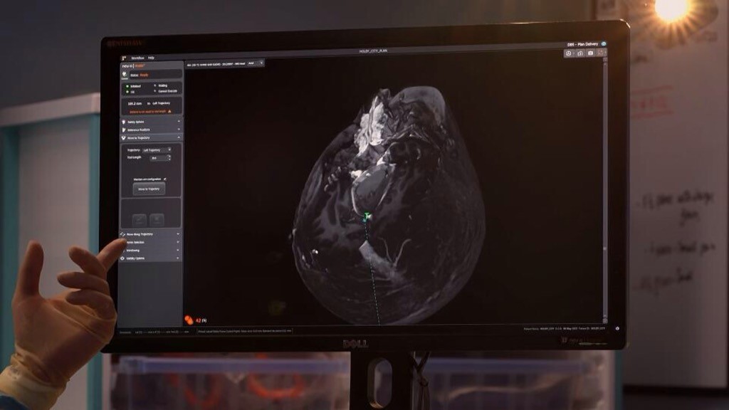 Renishaw's neuroinspire software used in Holby City