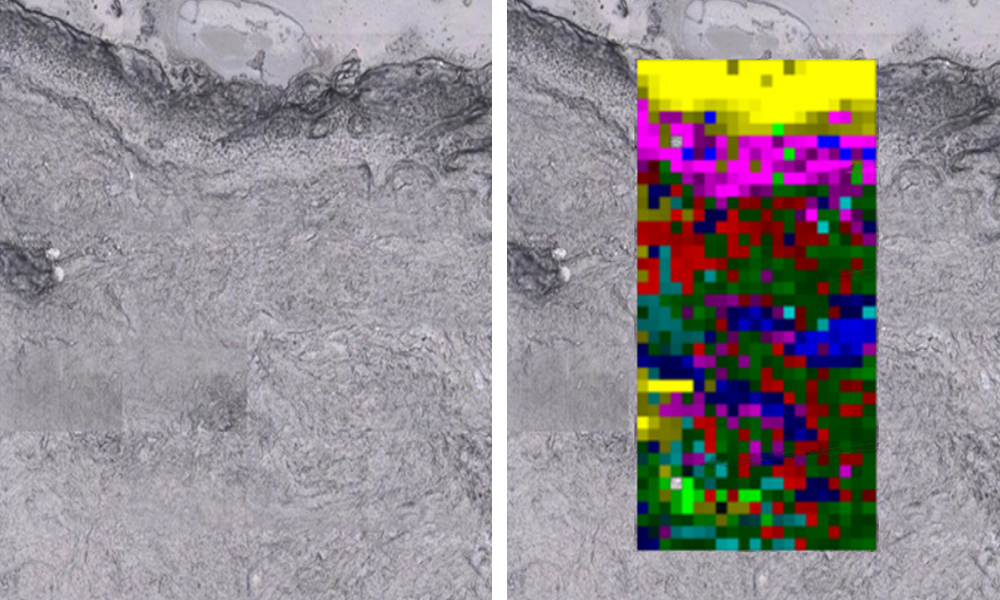 Image Raman transdermique