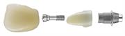 Link abutment expanded