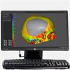 ADEPT software image - cranial plate, thickness