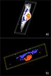 Images of glioma cells