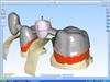 3D View of incise software