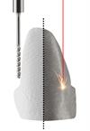 CoCr and Zr manufacturing Abutment