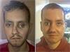 Stephen Power before and after his maxillofacial implant
