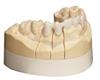 incise zirconia frameworks