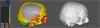 ADEPT software images - cranial plate, thickness