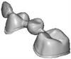 incise dental CAD CAM bridge