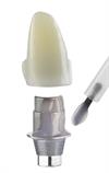 Bonding link and Abutment image