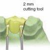 Checking pontic gaps