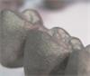 Implant bridge  image