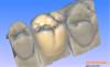 Screen shot of LinkAbutment