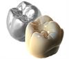 TruSmile crowns