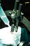 neuro | guide electrode introducer kit guide tube