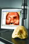 Cyclone - maxillofacial application