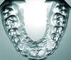 Dental plate