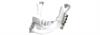 LaserImplant™ mandibular cutting and drilling guides
