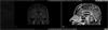 neuroinspire planning software banner