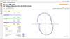 Ballbar 20 diagnostic software