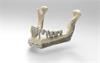 Jaw model with mandibular plate and replacement teeth