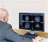 neuroinspire software is used in the planning of stereotactic neurosurgery