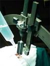 Inserting the neuro | guide electrode introducer kit guide tube which acts as a conduit for the stylette and the electrode.